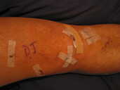 Photo: Gerald's knee