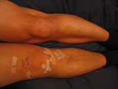Photo: Gerald's knees