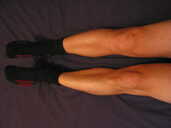 Photo: Gerald's knees