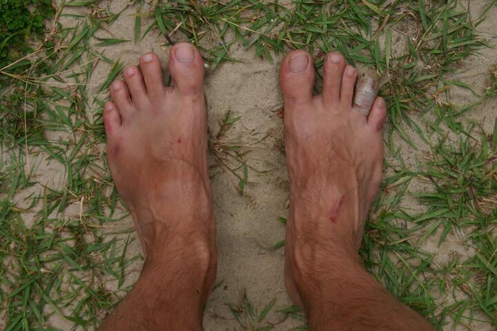 Scraped feet