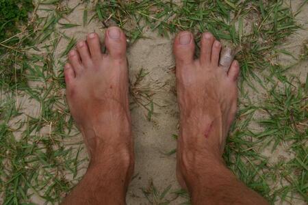 Photo: Scraped feet